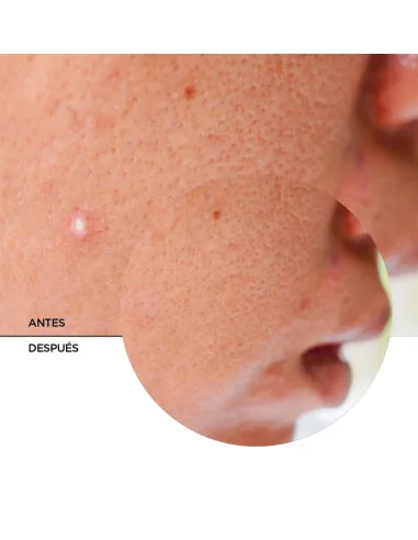 REVOX B77 JUST SUCCINIC ACID TRATAMIENTO ANTI-IMPERFECCIONES 25ML