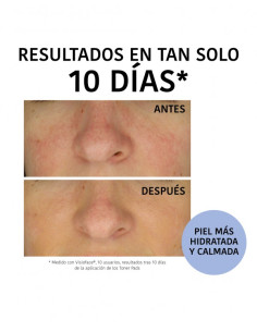 IROHA HYDRATING TONER 10 PADS 2